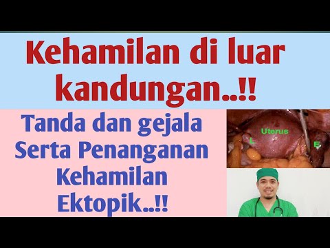 Video: Bagaimana Menyingkirkan Kehamilan Ektopik?