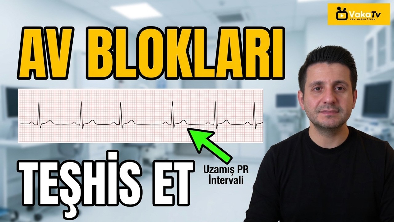 AV Bloklar Tek Video Anlatım I How to Identify AV Blocks on ECG - YouTube