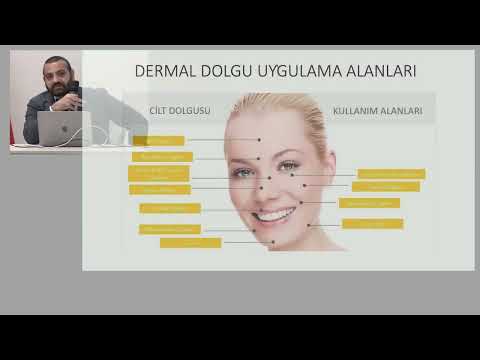 Botulinum Toksin ve
