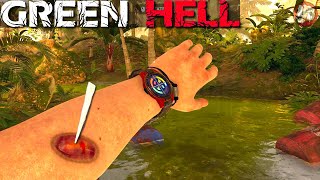 Worms Inside Of Us | Green Hell Gameplay | S5 Part 8