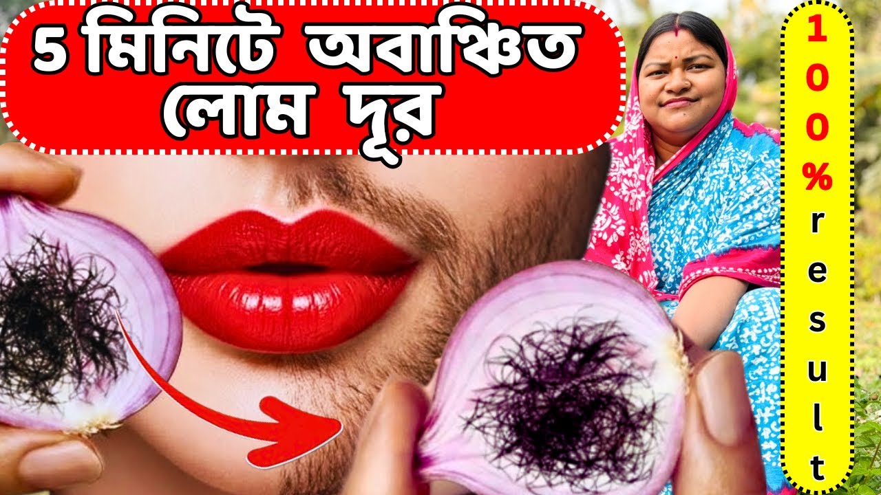 5 মিনিটে চিরতরে অবাঞ্চিত লোম  দূর হবে / hair removal remedy