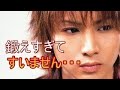 【衝撃】パニック障害を克服した芸能人トップ5!えっ!?あの芸能人もそうだったの??
