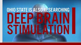 Ohio State leading breakthroughs in Alzheimer's and dementia research