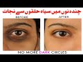 No More Dark Circles | Aankhon k Gird Siyah Halko&#39;n Sey Nijaat | آنکھوں کے گِرد سیاہ ہلکوں سے نجات