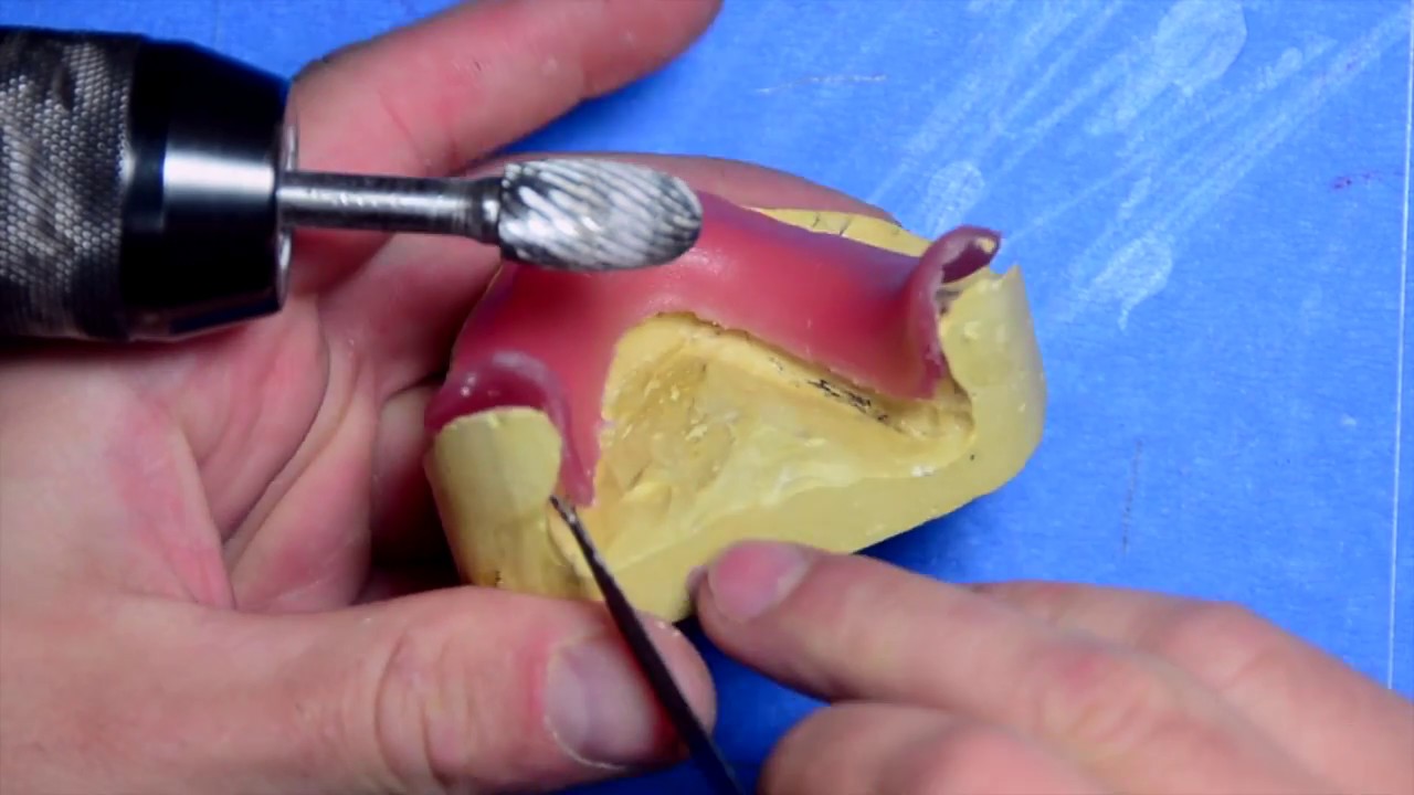 Upper&Lower Wax Bites YouTube