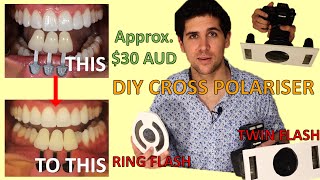 How To Make DIY Cross Polariser Filter At Home For Dental Photography (Ring Flash and Twin Flash) by Dr Paul's Dental World 4,702 views 1 year ago 14 minutes, 56 seconds