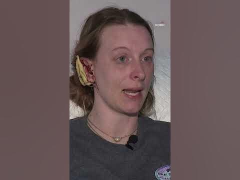 Loose pet monkey attacks woman, ripping 'handfuls of hair' and part of