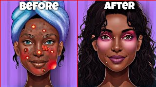 Asmr Helping A Poor Girl Removing Blackhead On Face .7