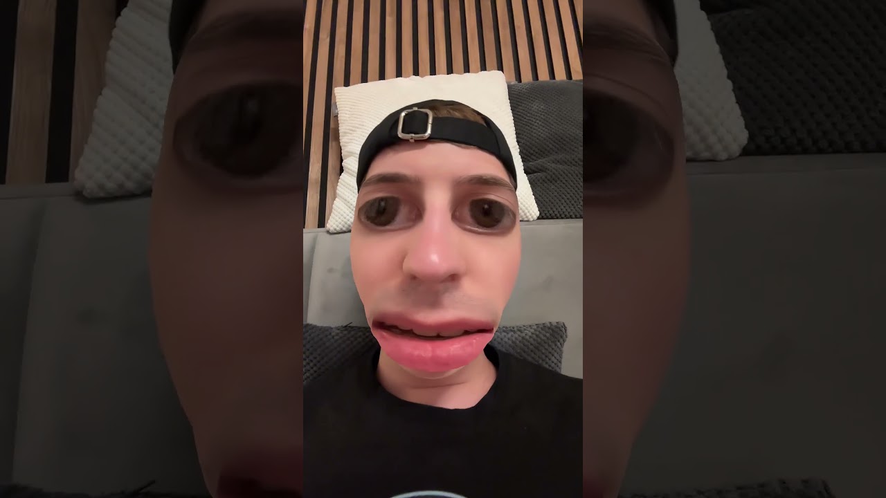 Was ist mit ClashGames passiert...😳 