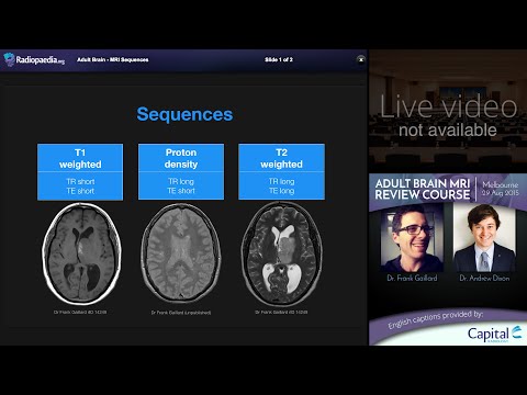 Video: Een MRI lezen: 15 stappen (met afbeeldingen)