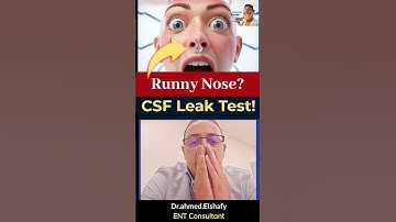 How to Check for a CSF Leak at Home? | ProHealth Consults #shorts
