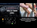 Ultrasound Tutorial: MSK Series: Achilles Tendon | Radiology Nation