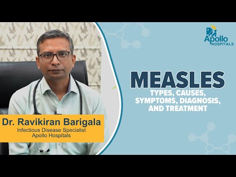 Measles: Symptoms | Causes | Diagnosis | Treatment | Dr Ravikiran Barigala