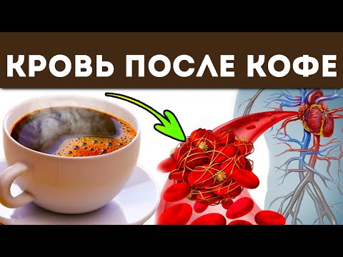 Как 1 кружка кофе изменяет нашу кровь! Польза и вред кофе для здоровья