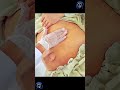 Abdominal examination for Umblical Hernia