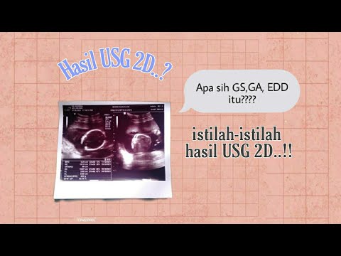 Cara Membaca Hasil USG 2 Dimensi - YouTube