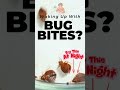 Waking Up With #bugbites ? Watch This #diy  #bedbuginfestation flea #bedbugremoval #bedbugs #fleas