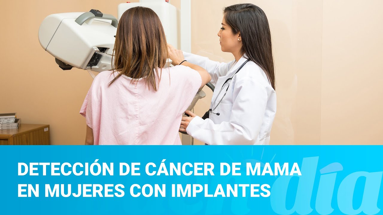 Detección de cáncer de mama en mujeres con implantes - YouTube
