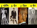 इन लोगों की कहानी सुनकर आपको रोना आ जाएगा|The Real Story Of Edward Mordrake, 'The Man With Two Faces