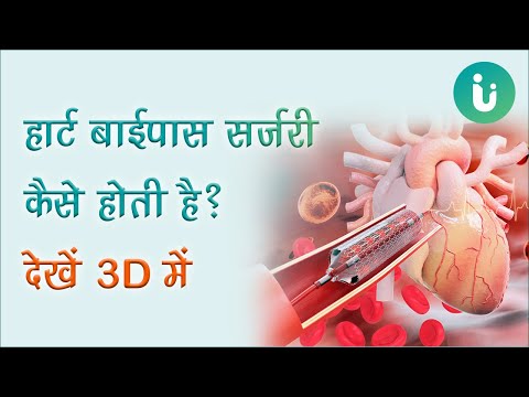 वीडियो: एडिरोंडैक्स में किस प्रकार की चट्टानें पाई जाती हैं?