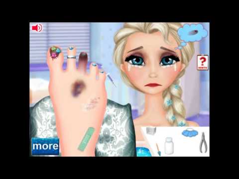 Jogosdafrozen.com-Elsa Foot Doctor Fun Games
