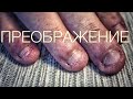 ногти грызуна. преображение. обкусанные ногти/часть 1