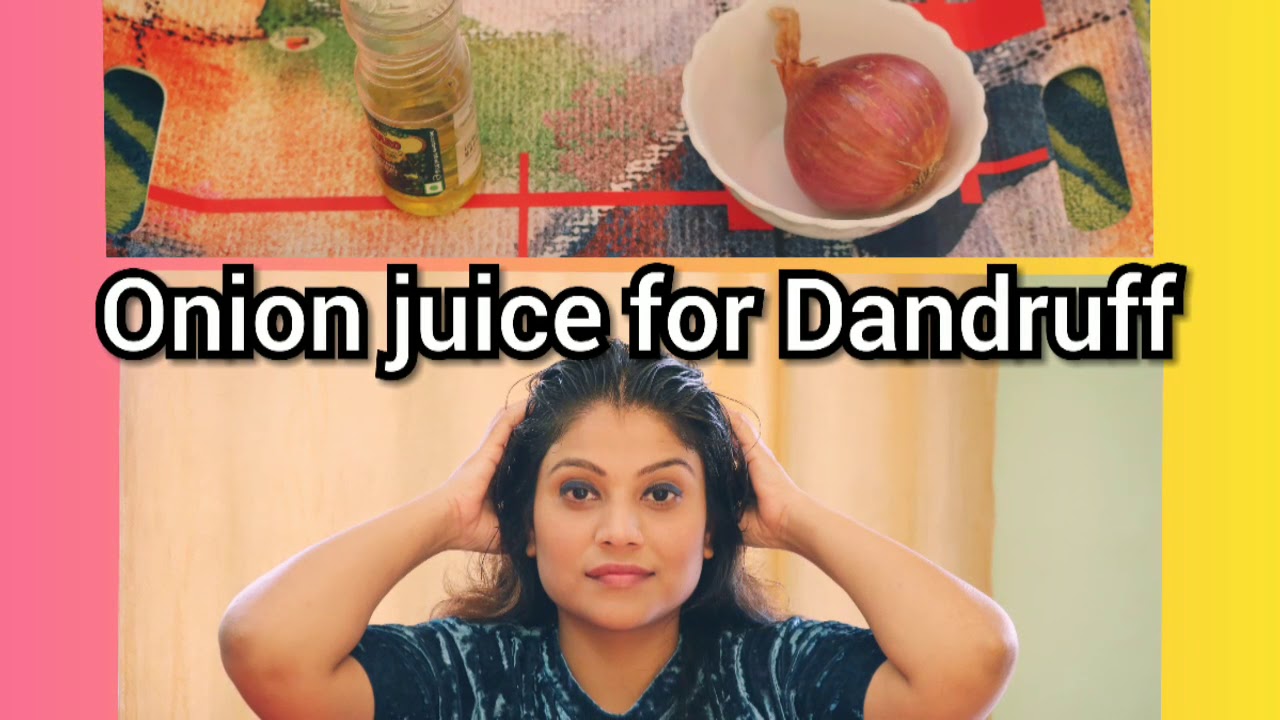 How to use onion juice for Dandruff,hair loss. प्याज के रस से डैंड्रफ
