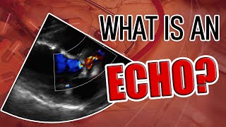 What is an Echocardiogram? by Dr. Pradip Jamnadas, MD 61,253 views 3 years ago 3 minutes, 5 seconds