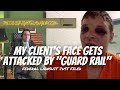 My Client’s Face Has Freak Encounter with a “Guard Rail” - Civil Rights Lawsuit Filed
