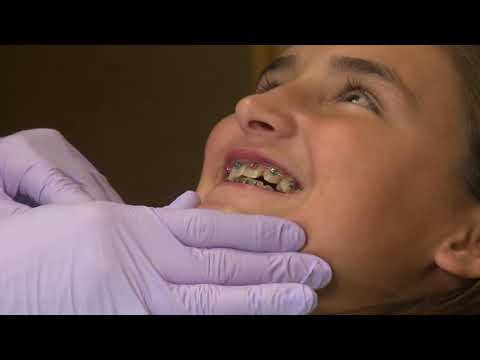 Tupelo, MS - Dr. Richard Caron "Your Dental Health" At Home Orthodontics