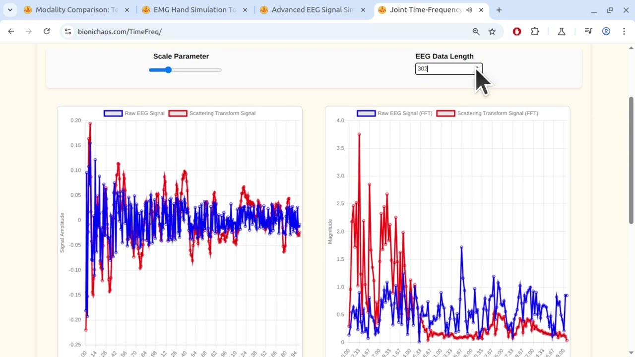 AI Unlocks Brainwaves: Advanced Seizure Detection with Joint Time-Frequency Scattering