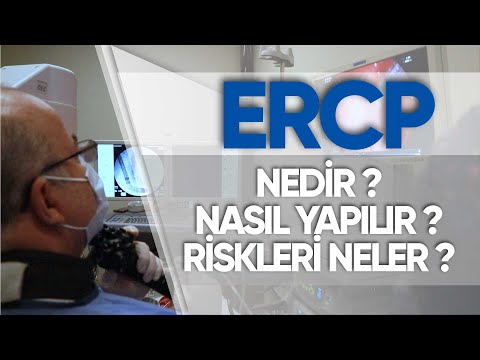 ERCP Nedir | Prof. Dr. Yusuf AKCAN