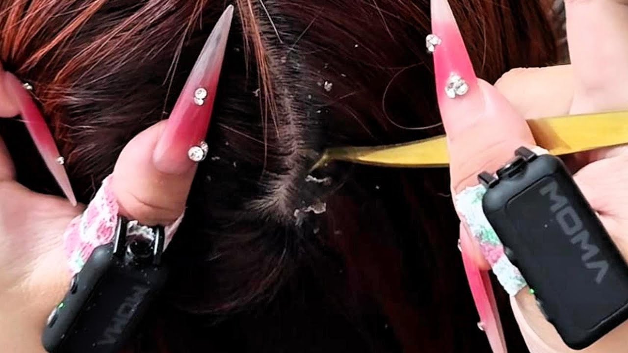 Latte ASMR | Long Nail Scalp Scratching for Calm & Sleep