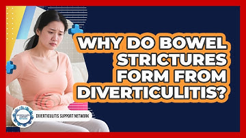 Why Do Bowel Strictures Form From Diverticulitis?