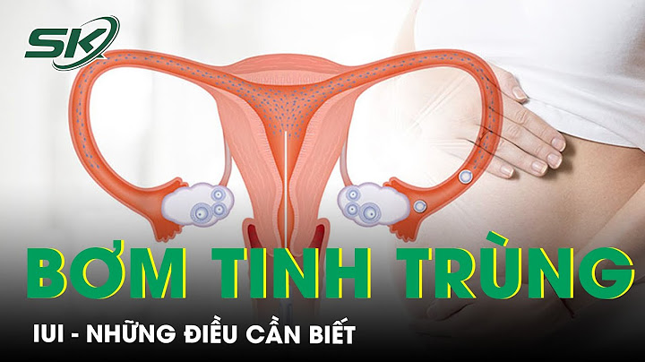 Bơm tinh trùng vào tử cung như thế nào