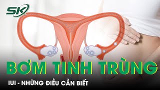 Những Điều Bạn Cần Biết Về Phương Pháp Bơm Tinh Trùng Vào Tử Cung (IUI) | SKĐS