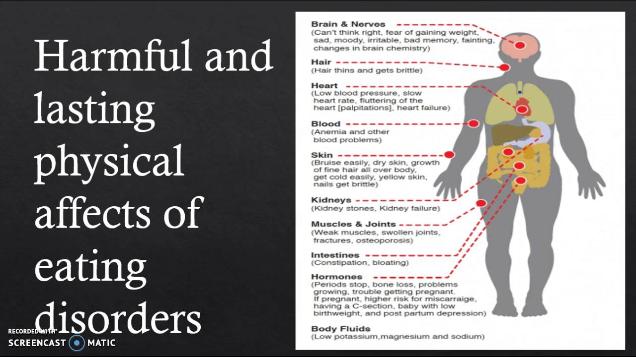 Eating Disorders. Living in Fear of gaining Weight. Fear of gaining Weight.