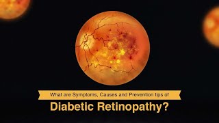 What are Symptoms, Causes and Prevention tips of Diabetic Retinopathy? (3D)