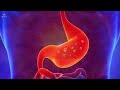 Indigestion - Miracle Rife Healing Frequency | Pure Binaural Beats Sound Healing Therapy