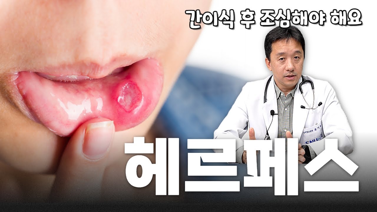 (EP181) 면역력 떨어지면 치명적인 바이러스 feat.헤르페스(CMV, EBV) | 서울대병원 소아청소년과 윤기욱 교수, 간담췌외과 김재윤 전임의