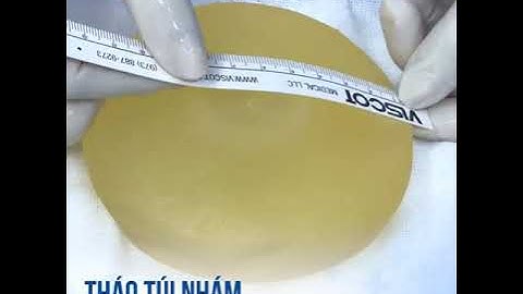 Tháo túi ngực nhám không rõ nguồn gốc, đặt túi Mentor mới