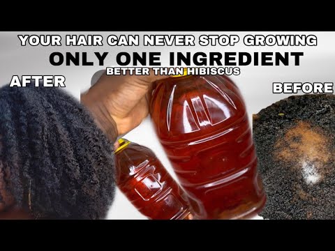 Cloves didn’t grow your hair? Try this instead! Better than cloves