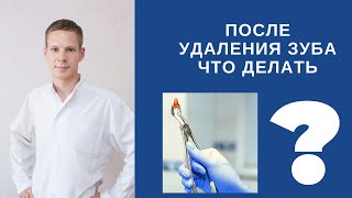 После удаления зуба что делать(Расширенные рекомендации 