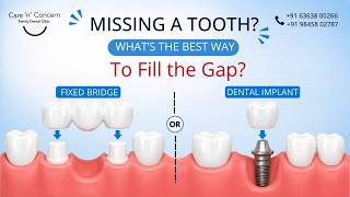 🦷 A Missing Tooth Can Cause Bigger Problems Than You Think!