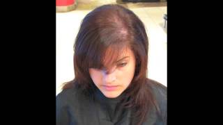 Dr Mache Seibel Interviewing Dr.Ryan Welter About Women Hair Loss after 40