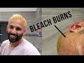 How NOT to bleach your hair! MY JOURNEY TO BLONDE :/
