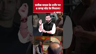 The horrifying truth about the wounds found on Prateek Yadav's body, the postmortem report shocke...