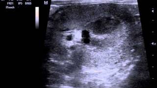 Камень в лоханке почки узи ветеринарная клиника.AVI(, 2011-02-24T20:04:26.000Z)