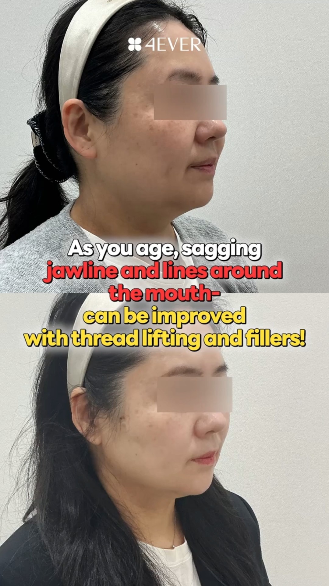 쇼츠