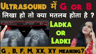 ultrasound me M, F, G, B, XX, XY ka kya matlab hota hai ।kya sach me gender prediction kar skte hai